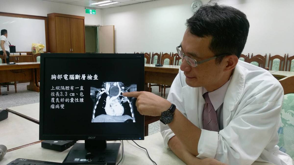 兒童肺炎後喘鳴 竟是縱膈腔囊腫