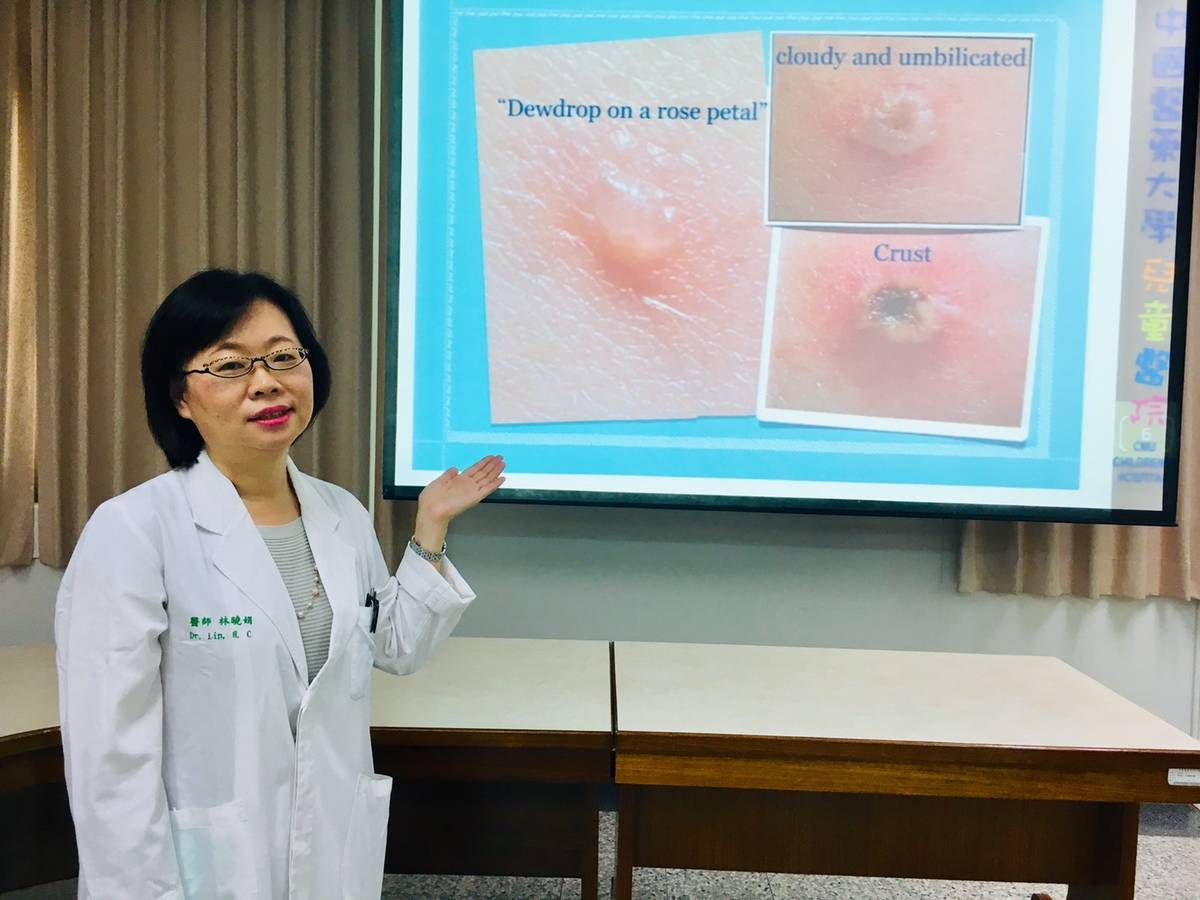 中國醫藥大學兒童醫院小兒感染科林曉娟醫師表示，小孩也會得「皮蛇」！