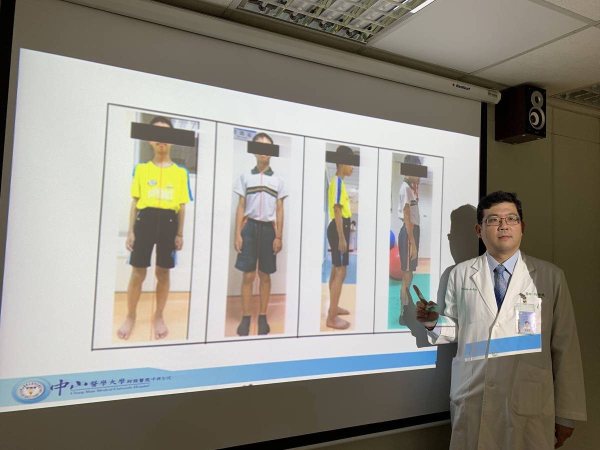 青少年腳不等長 應建立正確治療