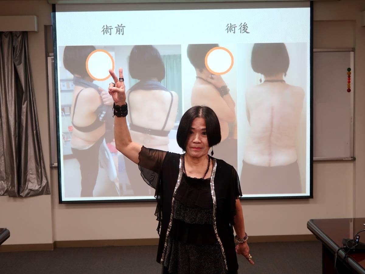 崔女士擺脫止痛藥人生