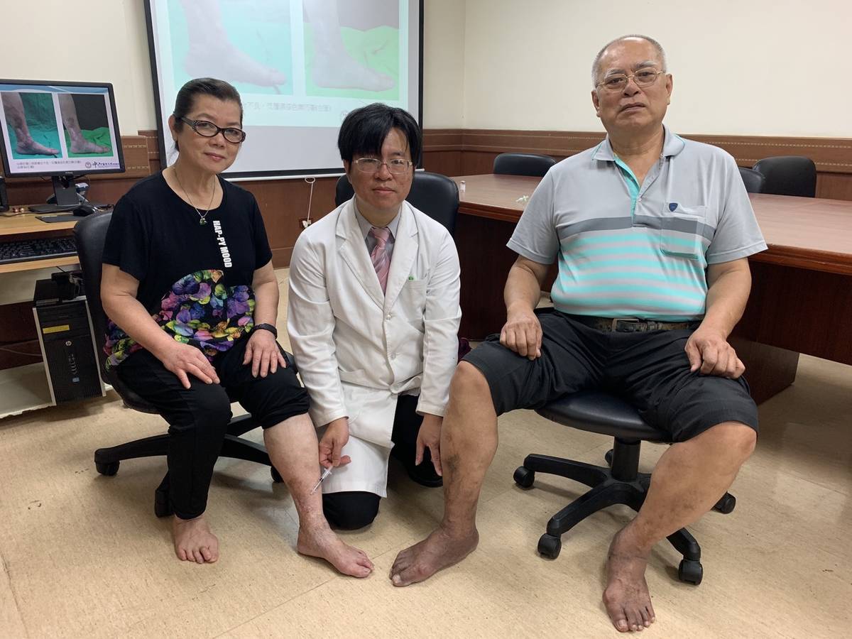 靜脈曲張診斷為烏腳病 隨便美容差點截肢