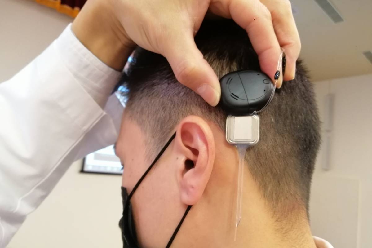 人工耳蝸