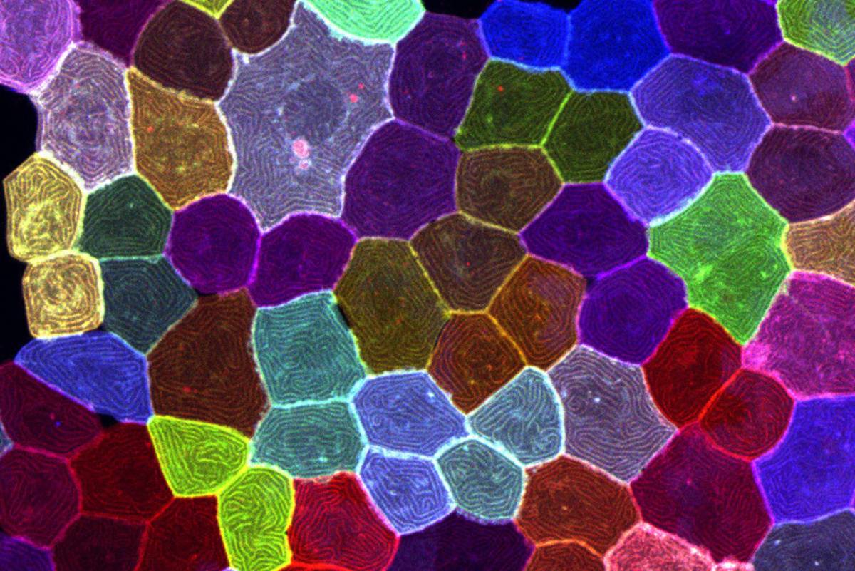 透過多顏色活細胞標誌，即時、高解析度追蹤斑馬魚體表所有皮膚細胞的動態行為(圖:中研院提供)