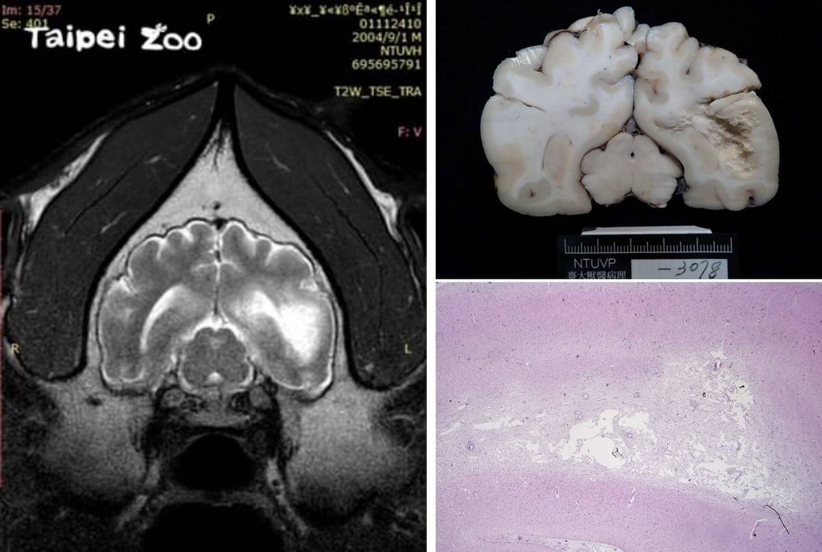 團團病理解剖報告出爐，確認大腦罹患「肥胖細胞型星形膠質細胞瘤