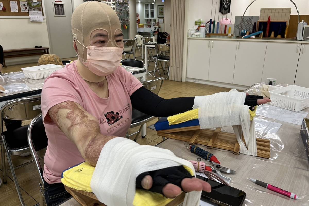 阿蘭離鄉復健，面對他人異樣眼光感到很難過