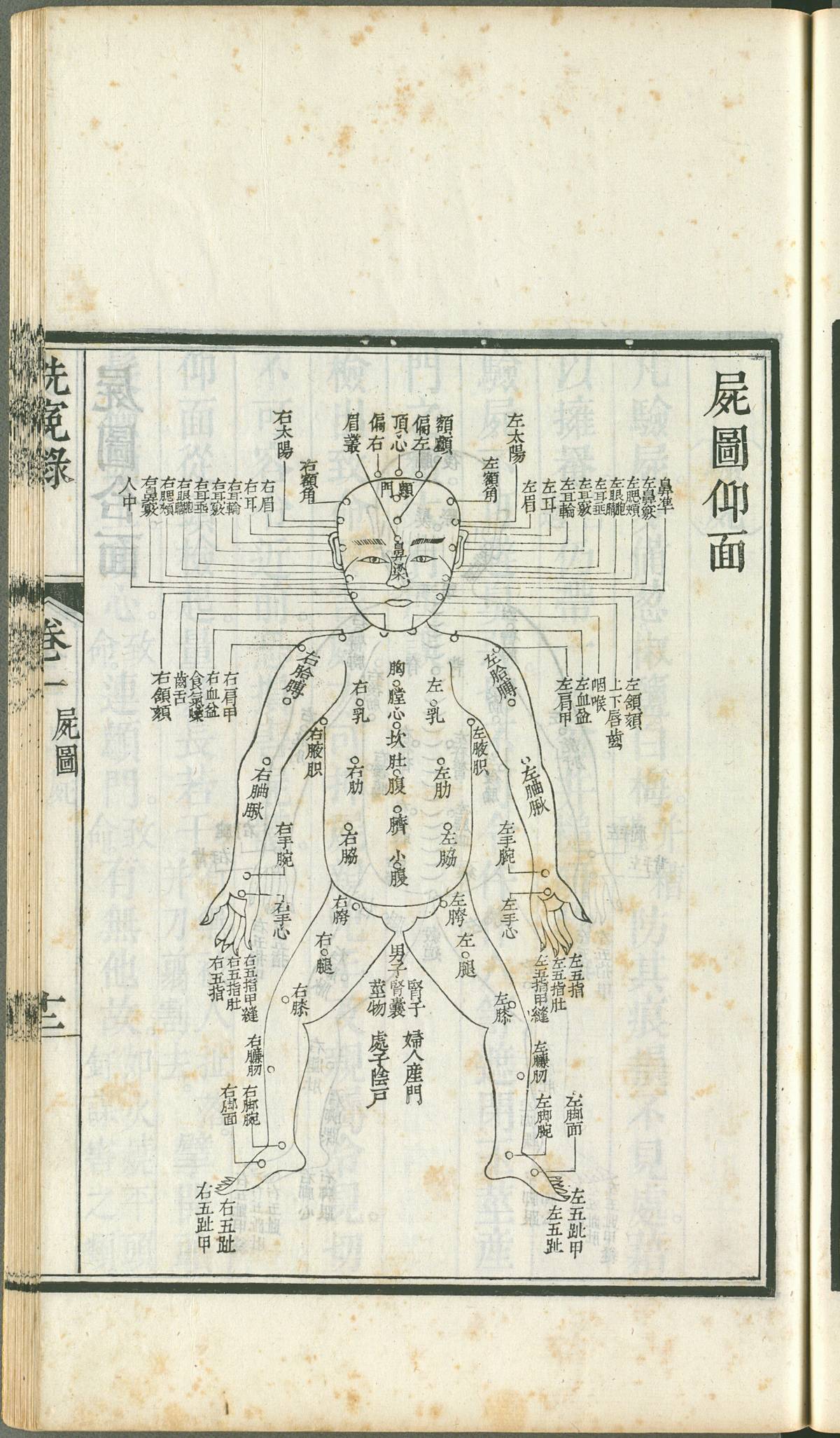 《律例館校正洗冤錄》屍圖(故宮提供)