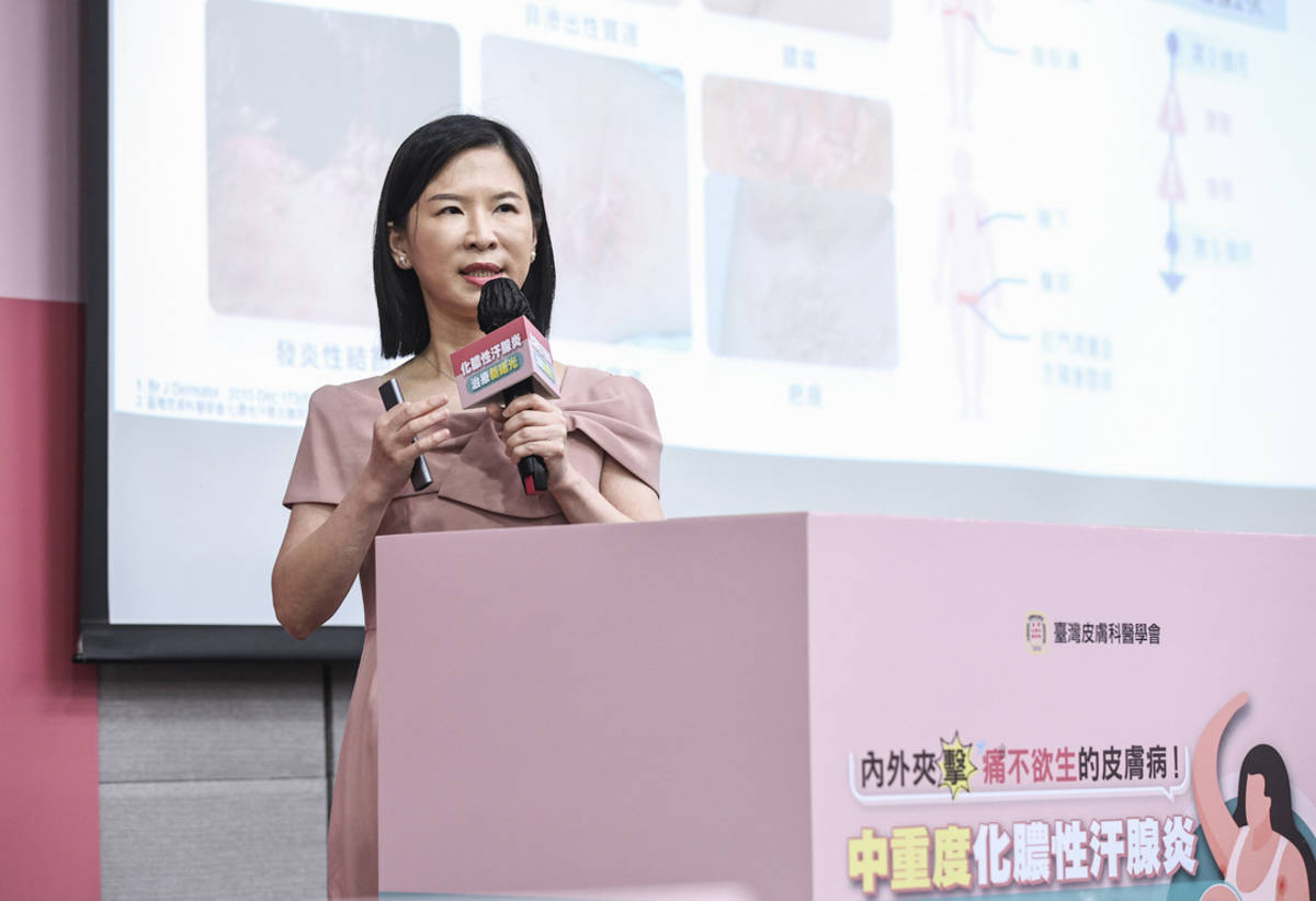 臺灣皮膚科醫學會黃毓惠秘書長說明，化膿性汗腺炎病灶類似青春痘